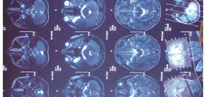 Detail of MRI scan output.